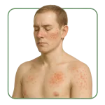 Antiallergici