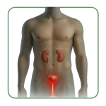 Infezione urinaria